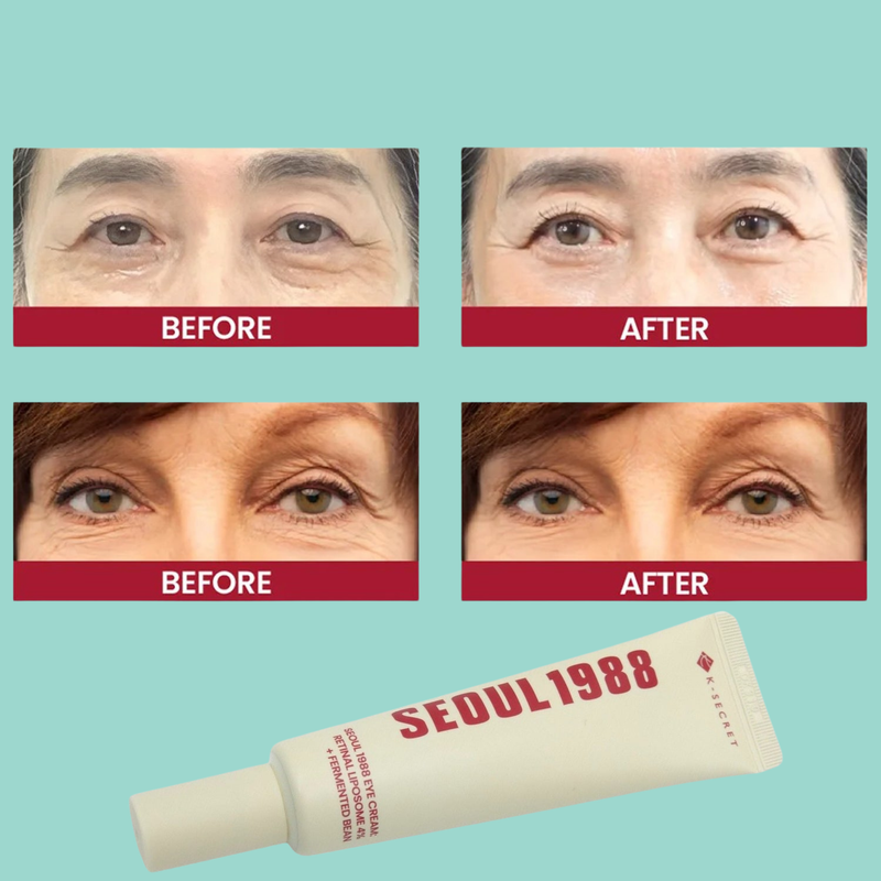 Seoul 1988 Eye Cream Retinal Liposome 4% + Fermented Bean 30ml — Illuminate. Firm. FOREVA.